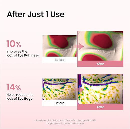 BIODANCE Collagen Peptide Under Eye Patches 60 Counts. Advanced Hydrogel Eye Patches for Dark Circles & Puffy Eyes. Under Eye Mask for Fine Lines. Eye Bags & Wrinkles. Korean Skincare.
